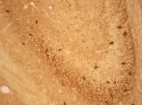 /album/fotogaleria-medium-spiny-neuron-labeled-with-dii-and-genegun/parva-20x-b-jpg/